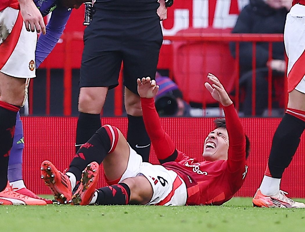  曼晚：利马预计赛季报销，卢克肖&多古&德里赫特可能踢左中卫